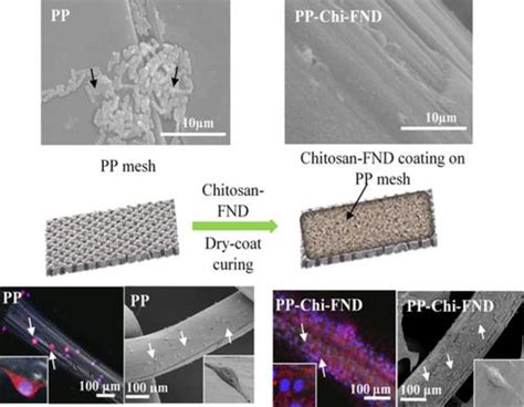  NanodiamondImplant: Den gnistrande revolutionen i biokompatibilitet och mekanisk styrka!